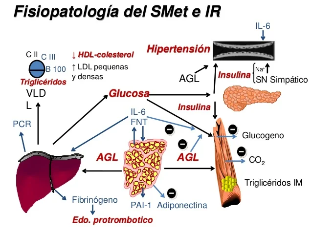 SÍNDROME METABÓLICO, NUEVO FACTOR EN EL AUMENTO DE CIRROSIS HEPÁTICA