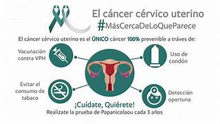 MÉXICO CUENTA CON LAS MEJORES HERRAMIENTAS PARA PREVENIR, DETECTAR Y TRATAR EL CÁNCER CERVICOUTERINO
