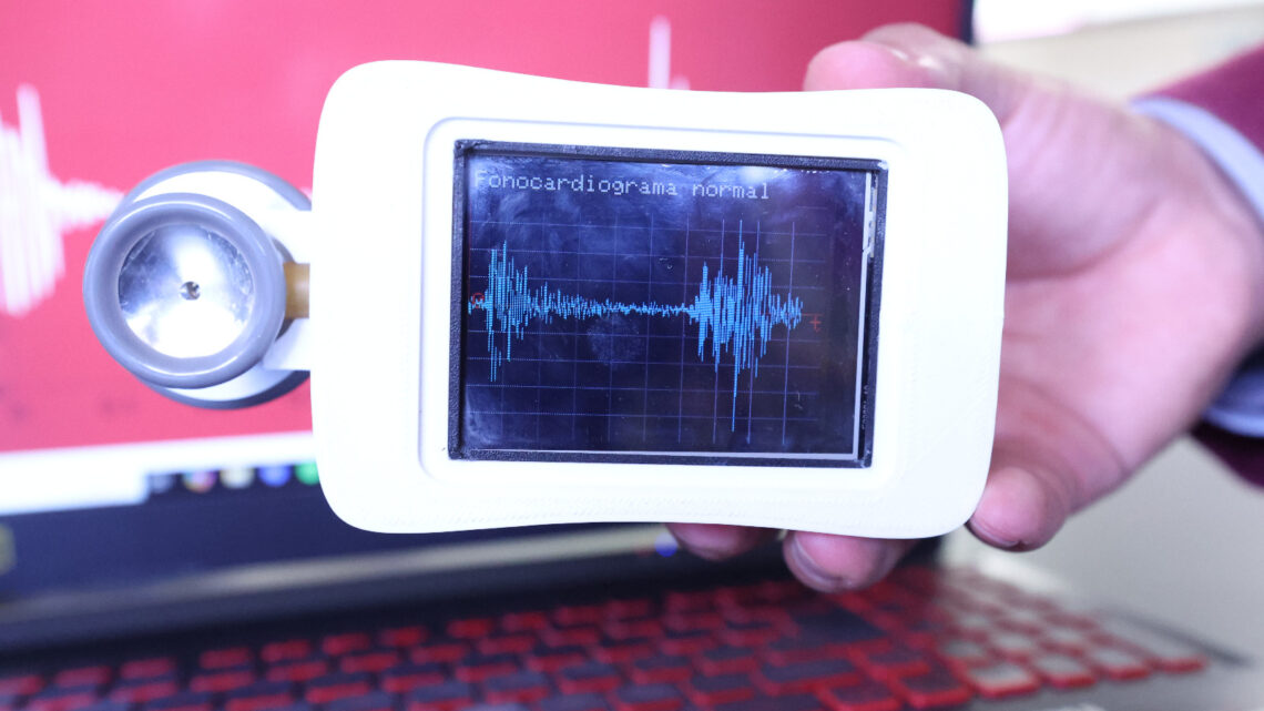 ESTETOSCOPIO QUE DETECTA DAÑO CARDIACO CON INTELIGENCIA ARTIFICIAL