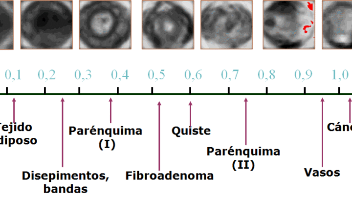LA MASTOGRAFÍA POR IMPEDANCIA ELÉCTRICA LA MASTOGRAFÍA POR IMPEDANCIA ELÉCTRICA