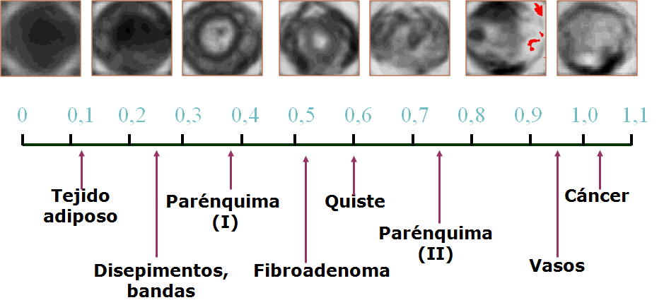 LA MASTOGRAFÍA POR IMPEDANCIA ELÉCTRICA LA MASTOGRAFÍA POR IMPEDANCIA ELÉCTRICA