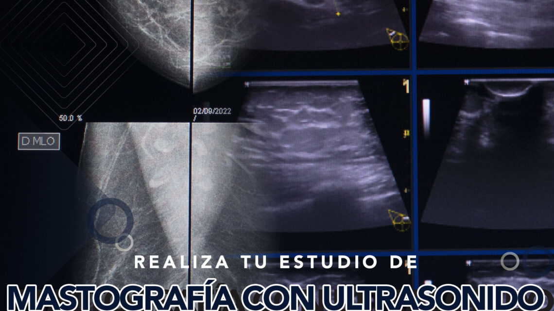¿EN QUÉ SE DIFERENCIA UN ULTRASONIDO DE MAMA DE UNA MASTOGRAFÍA? ¿EN QUÉ SE DIFERENCIA UN ULTRASONIDO DE MAMA DE UNA MASTOGRAFÍA?