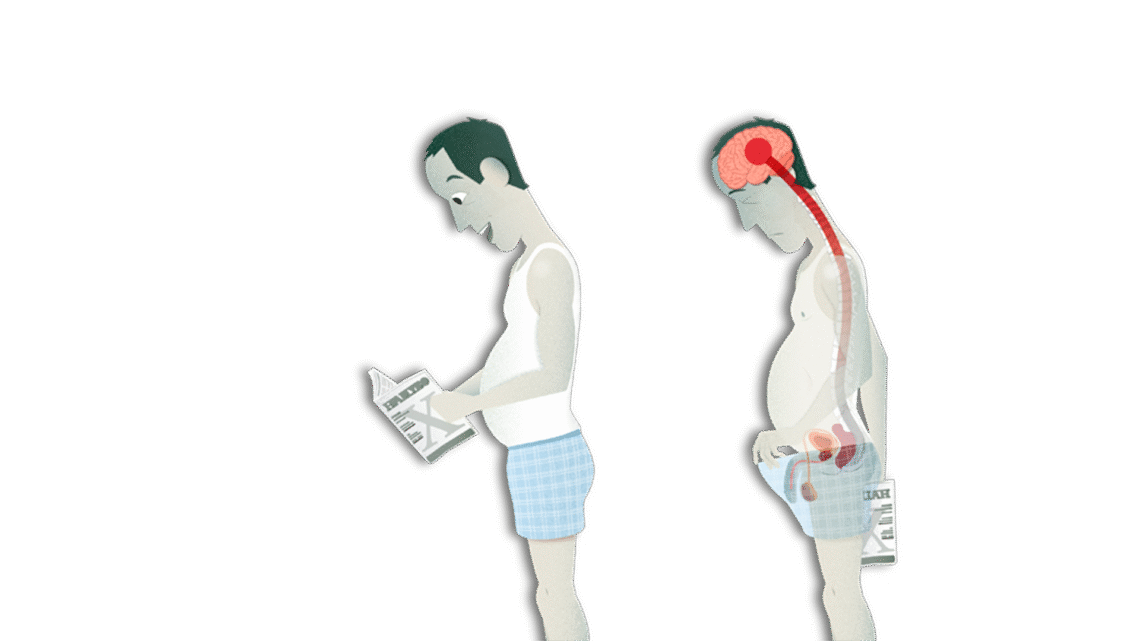 DISFUNCIÓN ERÉCTIL