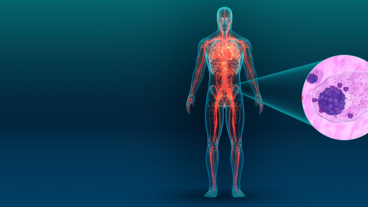 NUEVO BLANCO TERAPÉUTICO CONTRA EL MIELOMA MÚLTIPLE