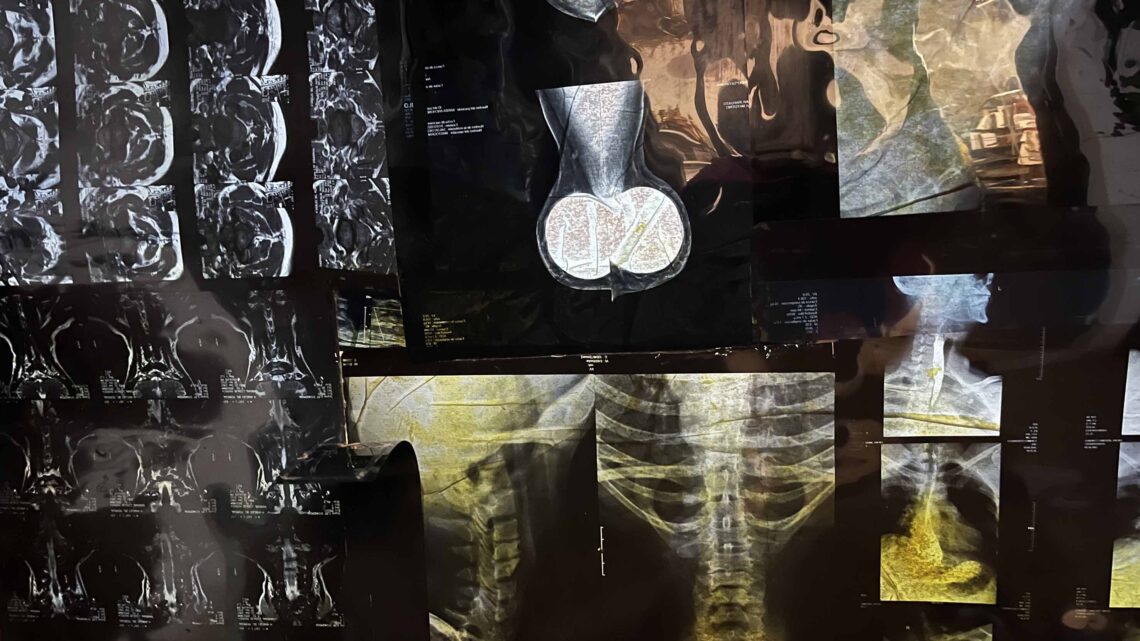 AUTORADIOGRÁFICAS: EL CUERPO INTERIOR