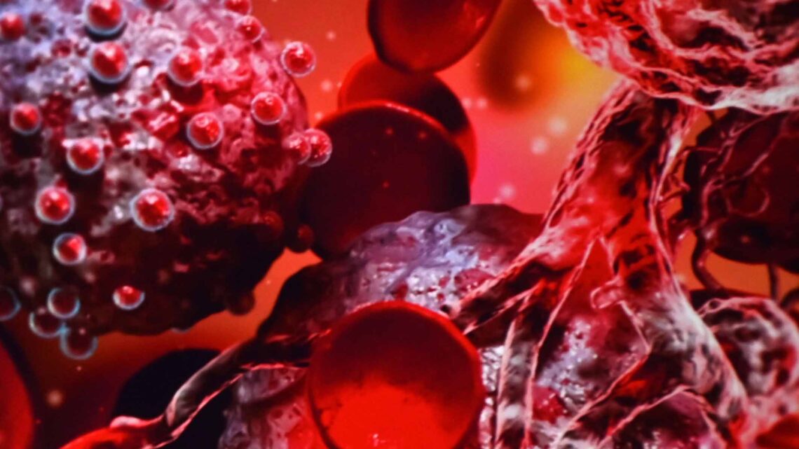 TECNOLOGÍA DE ÚLTIMA GENERACIÓN EN DETECCIÓN DE CÁNCER