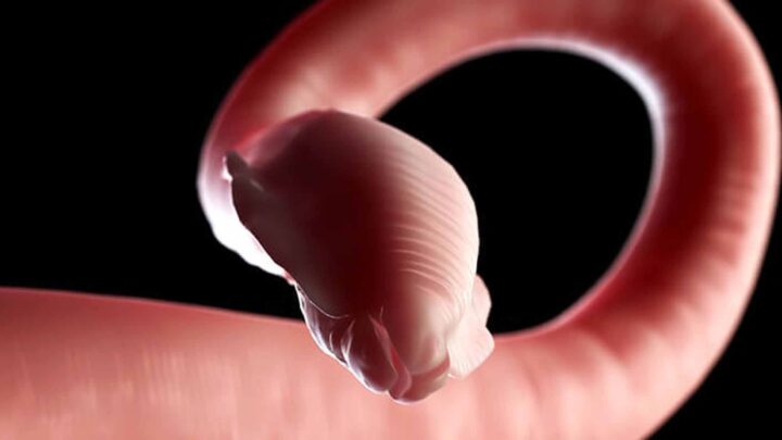 AVANZAN INVESTIGACIONES INTERINSTITUCIONALES CONTRA LA CISTICERCOSIS